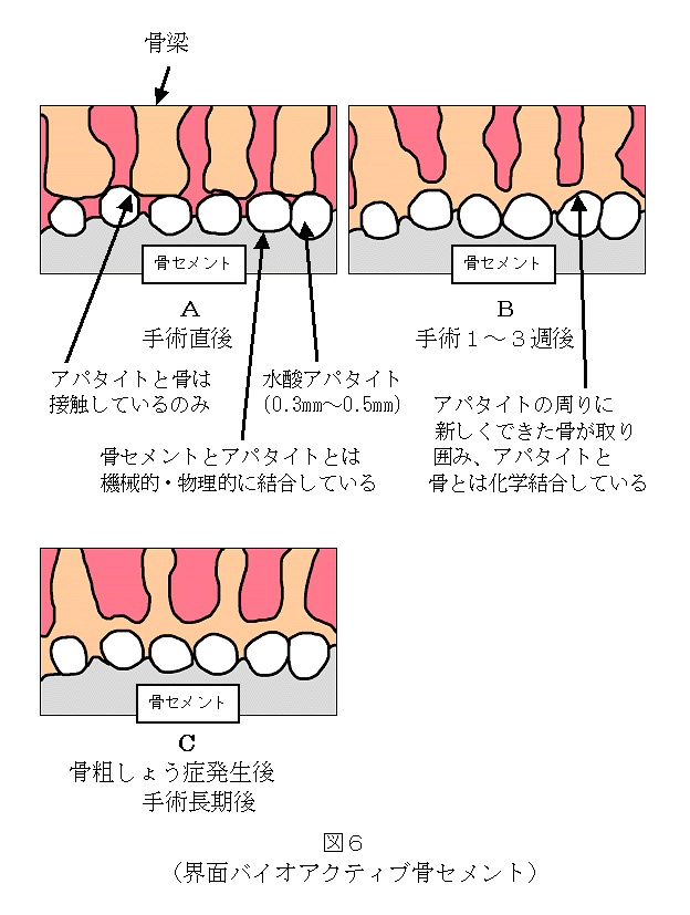 医療法人寿会 富永病院 大西啓靖記念 人工関節研究センター